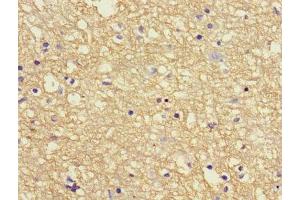 Immunohistochemistry of paraffin-embedded human brain tissue using ABIN7144042 at dilution of 1:100 (APP Antikörper  (AA 18-270))