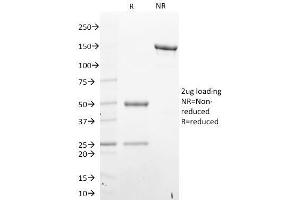 SDS-PAGE Analysis Purified STAT6 Mouse Monoclonal Antibody (STAT6/2410). (STAT6 Antikörper)