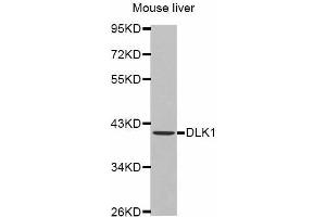 Western Blotting (WB) image for anti-delta-Like 1 Homolog (Drosophila) (DLK1) antibody (ABIN6219768) (DLK1 Antikörper)