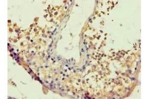 Immunohistochemistry analysis of paraffin-embedded (BACH1 Antikörper  (AA 1-320))