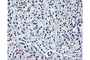 Immunohistochemical staining of paraffin-embedded colon tissue using anti-KIAA1609 mouse monoclonal antibody. (KIAA1609 Antikörper)