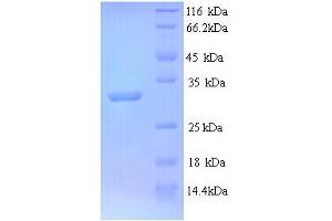 SDS-PAGE (SDS) image for Leptin (LEP) (AA 88-294) protein (His tag) (ABIN5714310)