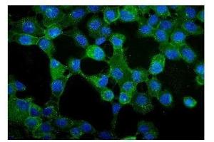 IF analysis of gamma Catenin using anti-gamma Catenin antibody (ABIN3043864). (JUP Antikörper  (AA 556-745))