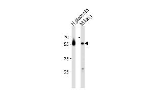 Western blot analysis in human placenta and mouse lung tissue lysates (35ug/lane). (CREB3L2 Antikörper  (C-Term))