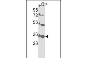 Western blot analysis of VDAC1 Antibody (Center) (ABIN390564 and ABIN2840894) in HL-60, Y79 cell line lysates (35 μg/lane). (VDAC1 Antikörper  (AA 95-124))