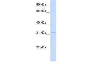 WB Suggested Anti-RDH12 Antibody Titration: 0. (RDH12 Antikörper  (Middle Region))