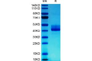SDS-PAGE (SDS) image for Tumor Necrosis Factor Receptor Superfamily, Member 13C (TNFRSF13C) (AA 7-71) protein (Fc Tag) (ABIN7273912)