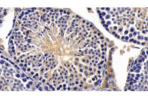 Detection of AMH in Mouse Testis Tissue using Monoclonal Antibody to Anti-Mullerian Hormone (AMH) (AMH Antikörper  (AA 453-560))