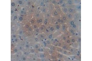Immunohistochemistry (IHC) image for anti-Matrix Metallopeptidase 19 (MMP19) (AA 99-512) antibody (ABIN1869239)