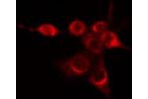 ABIN6274423 staining Hela cells by IF/ICC. (FUK Antikörper  (N-Term))