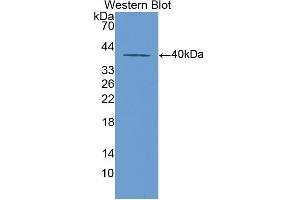 Western blot analysis of the recombinant protein. (KRT20 Antikörper  (AA 75-382))