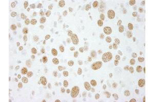 Immunohistochemistry (IHC) image for anti-RNA-binding protein Raly (RALY) (AA 256-306) antibody (ABIN7448753) (Raly Antikörper  (AA 256-306))