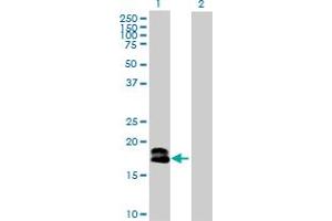 Western Blot analysis of IFNA1 expression in transfected 293T cell line by IFNA1 MaxPab polyclonal antibody. (IFNA1 Antikörper  (AA 1-189))