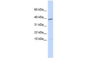 WB Suggested Anti-LEFTY1 Antibody Titration: 0. (LEFTY1 Antikörper  (N-Term))