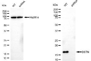 Western blotting analysis using DSTN antibody (ABIN7798321).