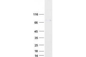 Western Blotting (WB) image for Oviductal Glycoprotein 1 (OVGP1) protein (Myc-DYKDDDDK Tag) (ABIN2726585)