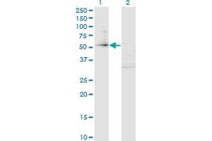 Western Blot analysis of ZFP161 expression in transfected 293T cell line by ZFP161 monoclonal antibody (M02A), clone 4F7. (ZBTB14/ZFP161 Antikörper  (AA 311-420))