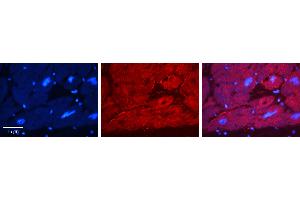 Rabbit Anti-EWSR1 Antibody   Formalin Fixed Paraffin Embedded Tissue: Human heart Tissue Observed Staining: Cytoplasmic, plasma membrane Primary Antibody Concentration: 1:100 Other Working Concentrations: 1:600 Secondary Antibody: Donkey anti-Rabbit-Cy3 Secondary Antibody Concentration: 1:200 Magnification: 20X Exposure Time: 0.