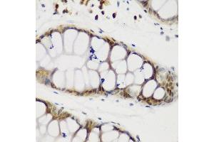 Immunohistochemistry of paraffin-embedded human gastric using NCL antibody at dilution of 1:200 (40x lens). (Nucleolin Antikörper)