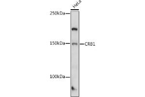 CRB1 Antikörper  (AA 20-200)