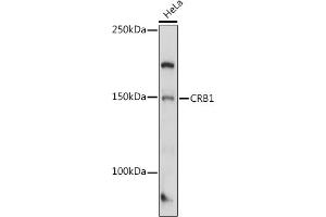Western blot analysis of extracts of HeLa cells, using CRB1 antibody (ABIN7266524) at 1:1000 dilution. (CRB1 Antikörper  (AA 20-200))