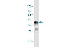 Western Blot detection against Immunogen (37. (MMP21 Antikörper  (AA 374-481))