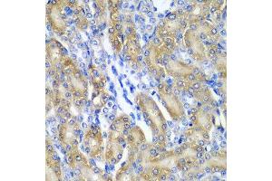 Immunohistochemistry of paraffin-embedded rat kidney using CRYAA antibody at dilution of 1:200 (40x lens). (CRYAA Antikörper)