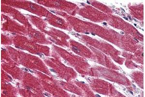 Anti-EDG3 / S1P3 antibody  ABIN1048532 IHC staining of human heart. (S1PR3 Antikörper  (N-Term))