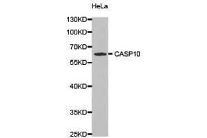 Western Blotting (WB) image for anti-Caspase 10, Apoptosis-Related Cysteine Peptidase (CASP10) antibody (ABIN1871452) (Caspase 10 Antikörper)
