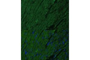 Immunofluorescence analysis of mouse heart cells using TNNI3 antibody (ABIN6132730, ABIN6149358, ABIN6149360 and ABIN6222761) at dilution of 1:100. (TNNI3 Antikörper  (AA 1-210))