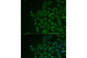 Immunofluorescence analysis of MCF7 cells using LRat Polyclonal Antibody (LRAT Antikörper)