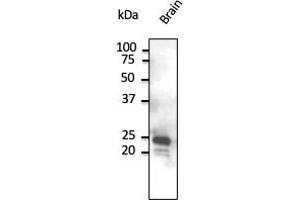 Western Blotting (WB) image for anti-RAB9B, Member RAS Oncogene Family (RAB9B) (C-Term) antibody (ABIN1440002) (RAB9B Antikörper  (C-Term))