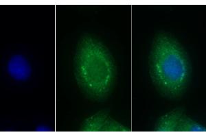Detection of EDN1 in Human Hela cell using Monoclonal Antibody to Endothelin 1 (EDN1) (Endothelin 1 Antikörper  (AA 53-203))
