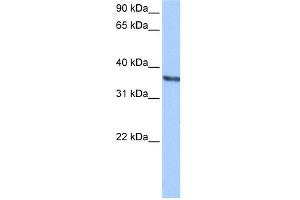 WB Suggested Anti-CHAD Antibody Titration: 0. (CHAD Antikörper  (Middle Region))