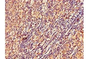 IHC image of ABIN7168978 diluted at 1:300 and staining in paraffin-embedded human lymph node tissue performed on a Leica BondTM system. (DRAK2 Antikörper  (AA 235-366))
