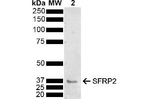 Western blot analysis of Mouse Brain showing detection of 33. (SFRP2 Antikörper  (AA 195-295) (HRP))