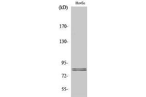 Western Blotting (WB) image for anti-Lipase, Hormone-Sensitive (LIPE) (Ser774) antibody (ABIN3185095) (LIPE Antikörper  (Ser774))