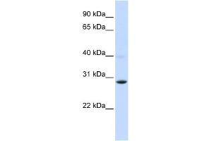 PGAM2 antibody used at 1 ug/ml to detect target protein. (PGAM2 Antikörper)