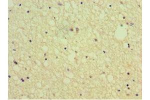 Immunohistochemistry (IHC) image for anti-Sema Domain, Immunoglobulin Domain (Ig), Transmembrane Domain (TM) and Short Cytoplasmic Domain, (Semaphorin) 4C (SEMA4C) (AA 749-833) antibody (ABIN7168802)
