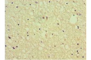 Immunohistochemistry of paraffin-embedded human brain tissue using ABIN7168802 at dilution of 1:100 (SEMA4C Antikörper  (AA 749-833))