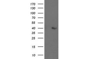 Western Blotting (WB) image for anti-Aldolase B, Fructose-Bisphosphate (ALDOB) antibody (ABIN1496606) (ALDOB Antikörper)