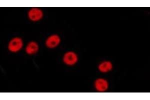 ABIN6278642 staining Hela by IF/ICC. (GTF3C3 Antikörper)