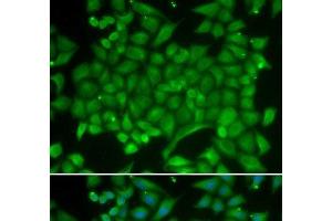 Immunofluorescence analysis of MCF-7 cells using RAB11A Polyclonal Antibody (RAB11A Antikörper)