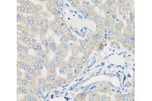 Immunohistochemistry of paraffin-embedded Rat liver using PYCR1 Polyclonal Antibody at dilution of 1:200 (40x lens). (PYCR1 Antikörper)