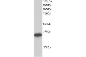 Image no. 2 for anti-Carbonyl Reductase 1 (CBR1) (C-Term) antibody (ABIN374238) (CBR1 Antikörper  (C-Term))