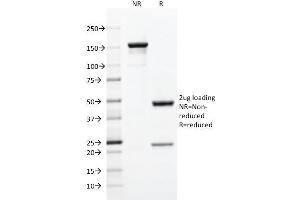 SDS-PAGE Analysis Purified CD5 Mouse Monoclonal Antibody (C5/473). (CD5 Antikörper)