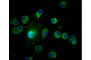 Immunofluorescence staining of MCF-7 cells with ABIN7167068 at 1:200, counter-stained with DAPI. (LAMTOR1 Antikörper  (AA 2-161))