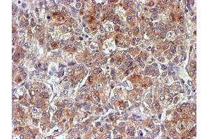 Image no. 3 for anti-NADH Dehydrogenase (Ubiquinone) Complex I, Assembly Factor 7 (NDUFAF7) antibody (ABIN1499667) (NDUFAF7 Antikörper)