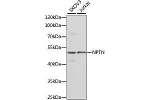 Western blot analysis of extracts of various cell lines using NPTN Polyclonal Antibody at dilution of 1:1000. (NPTN Antikörper)