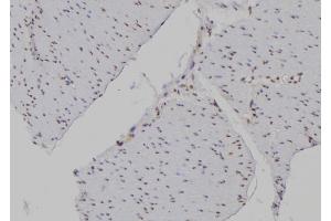 ABIN6277194 at 1/100 staining Human gastric tissue by IHC-P. (Histone 3 Antikörper  (H3K4me3))
